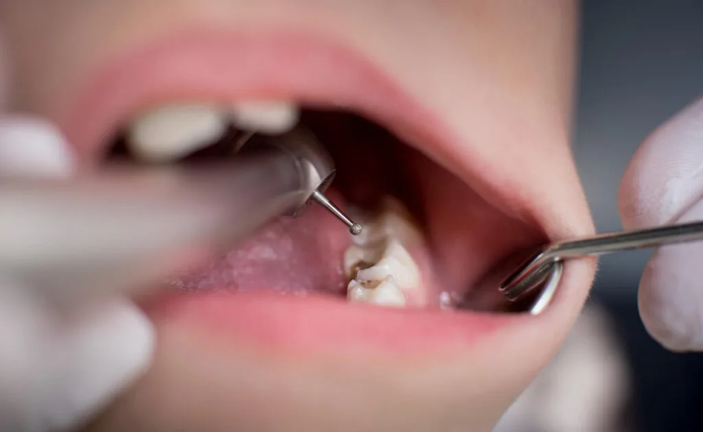 Empaste dental