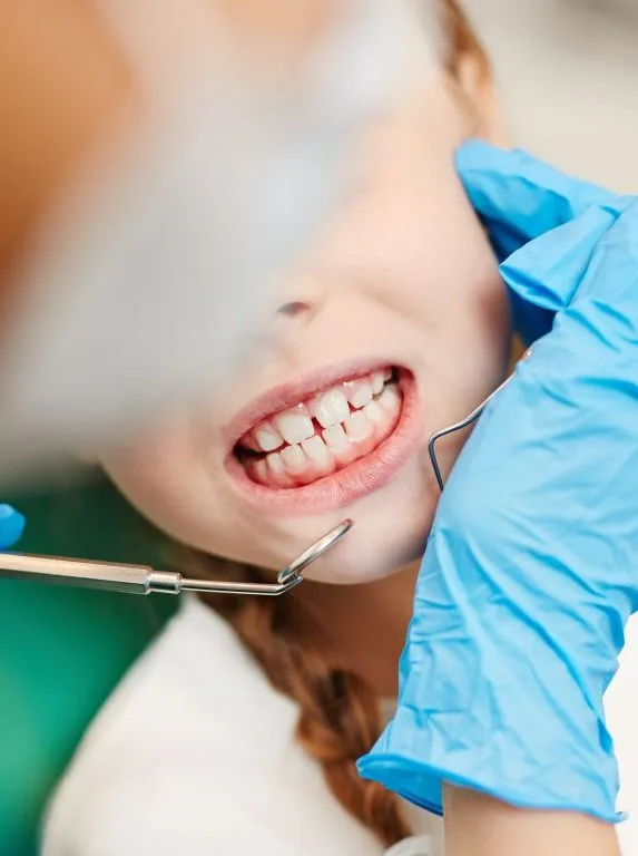 teeth-of-patient-B6TVM57
