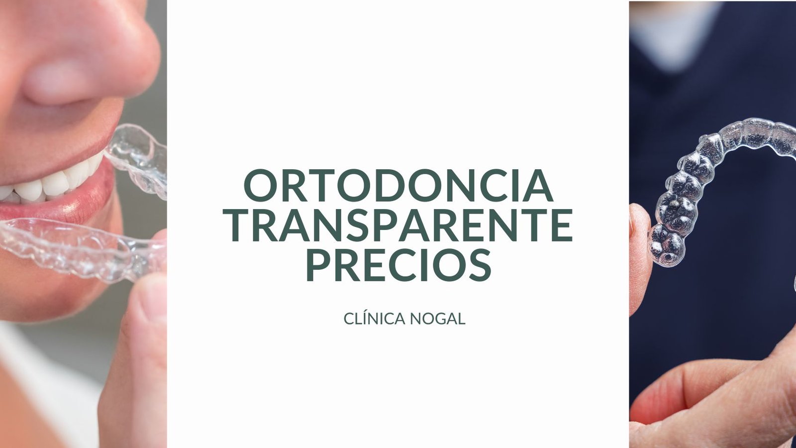 Ortodoncia transparente precios