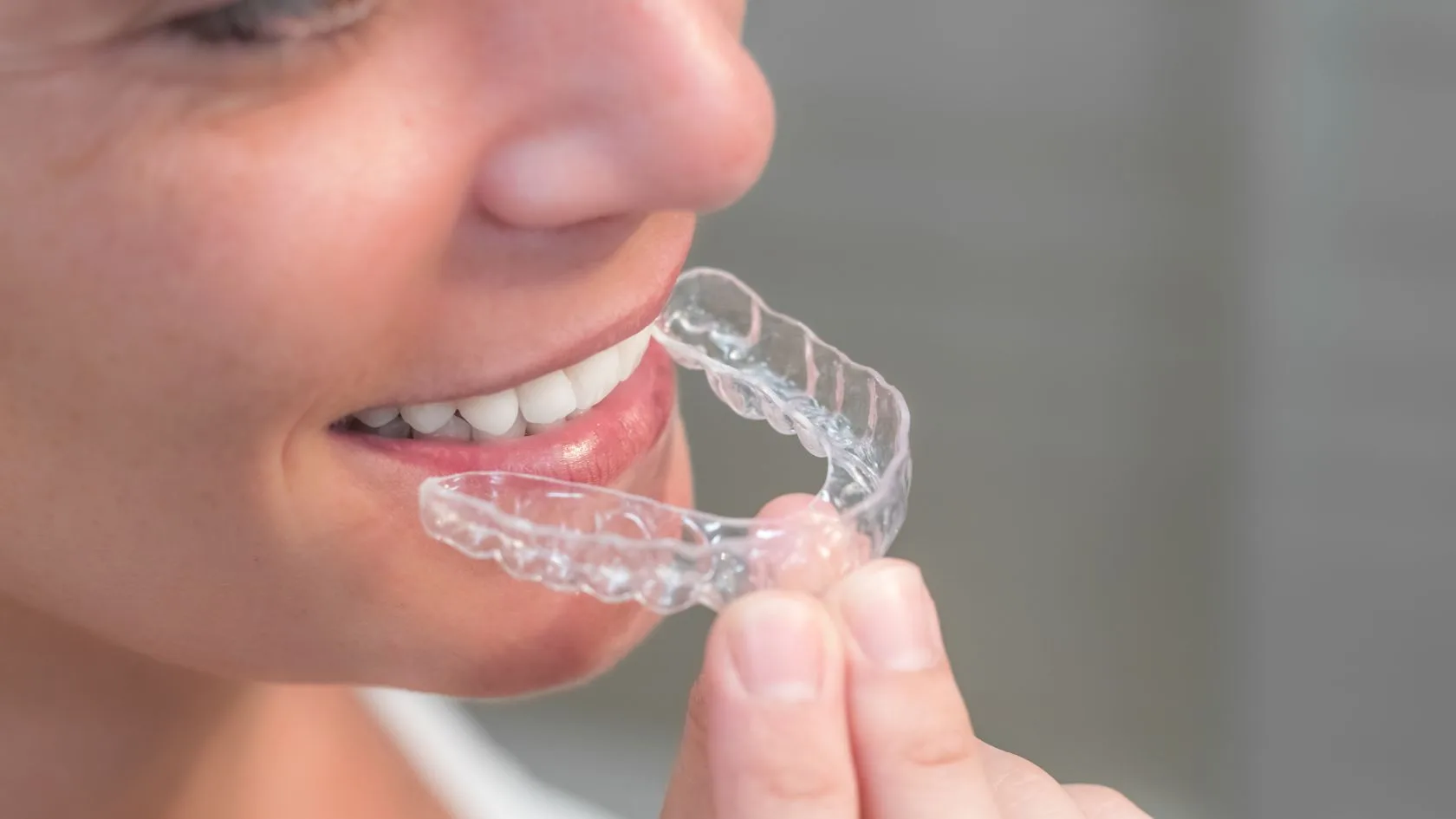 Ortodoncia transparente Ortodoncia transparente