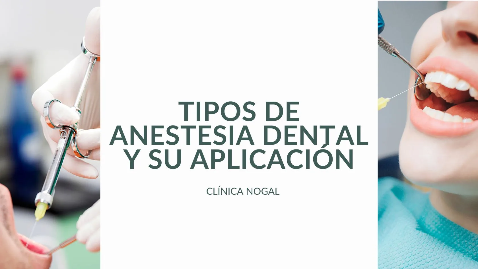 Tipos de anestesia local