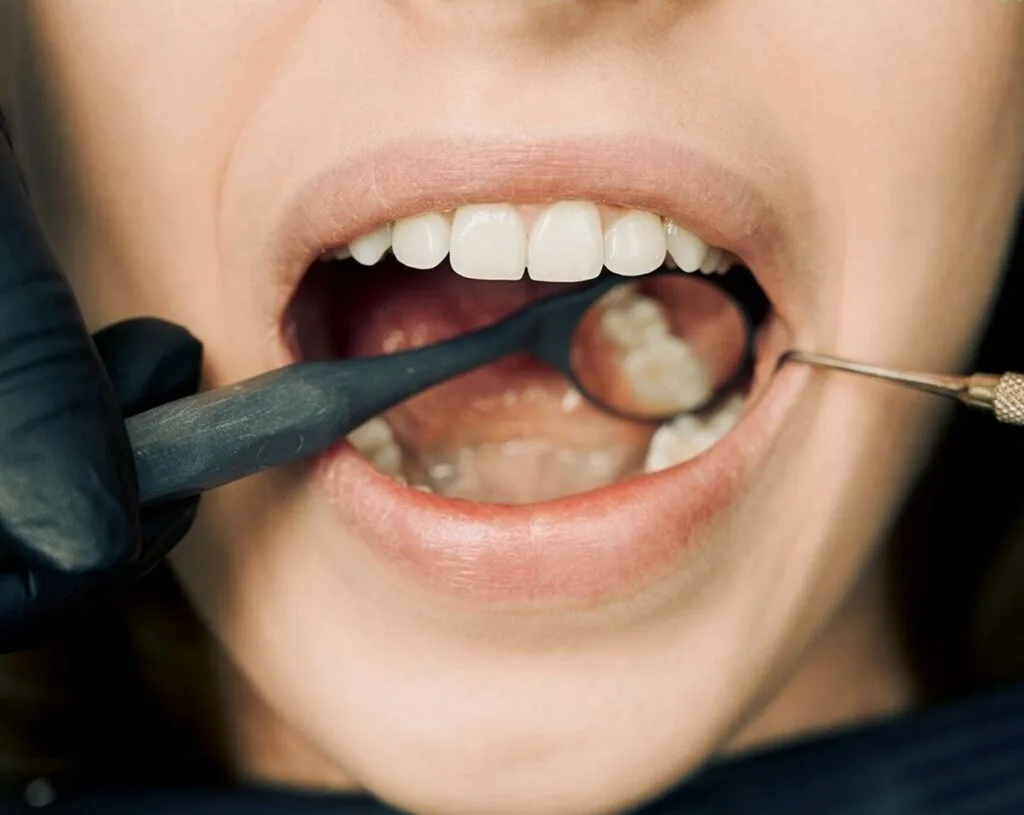 Anestesia dental