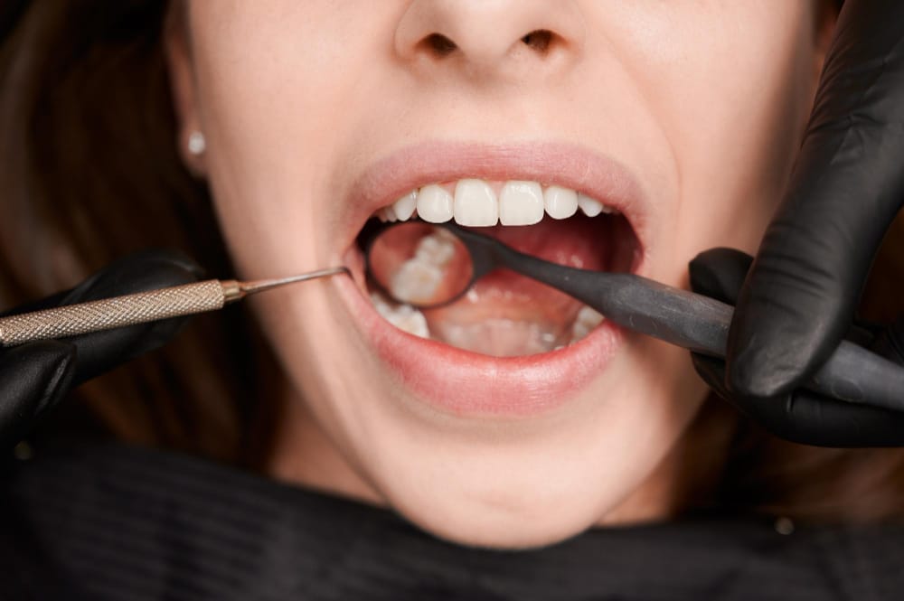 Periodoncia Periodoncia