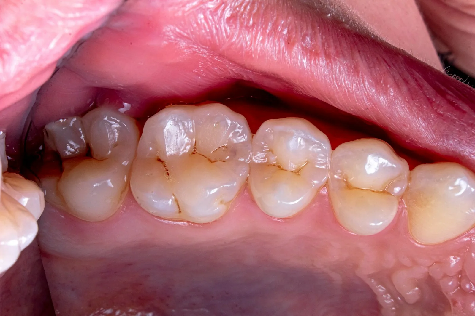 Photo by Ozkan Guner close-up of a person's mouth