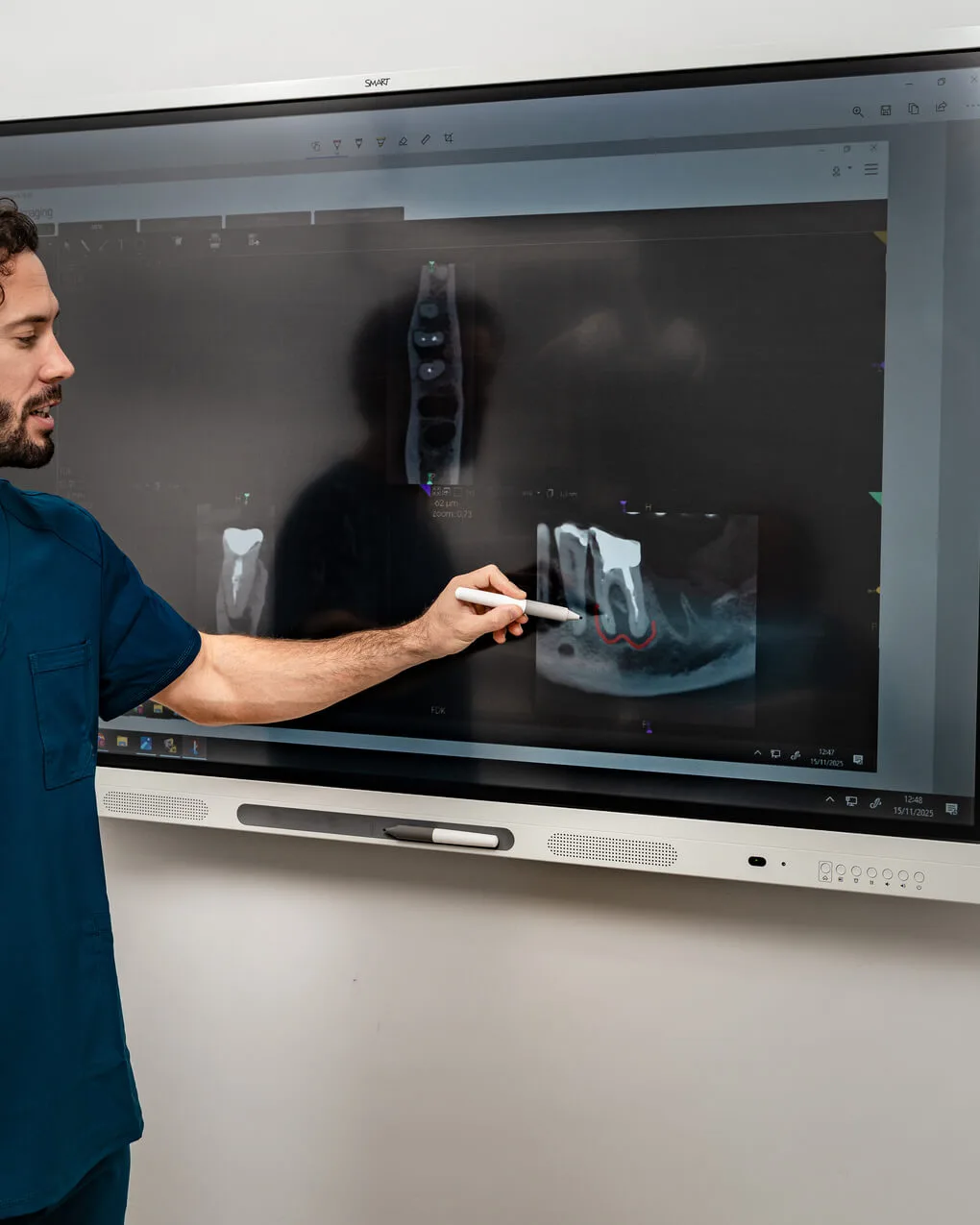 Odontología conservadora y Endodoncia Odontología conservadora y Endodoncia