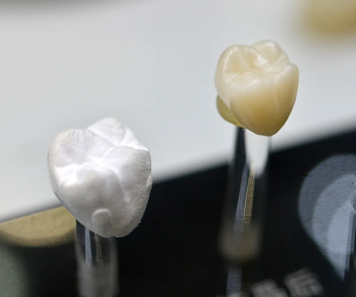 Prostodoncia y estetica dental Prostodoncia y estetica dental